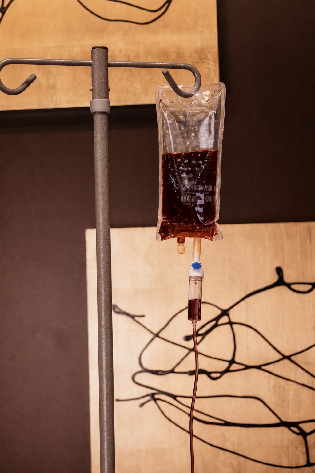 An iron infusion bag and drip chamber in the Onyx IV lounge